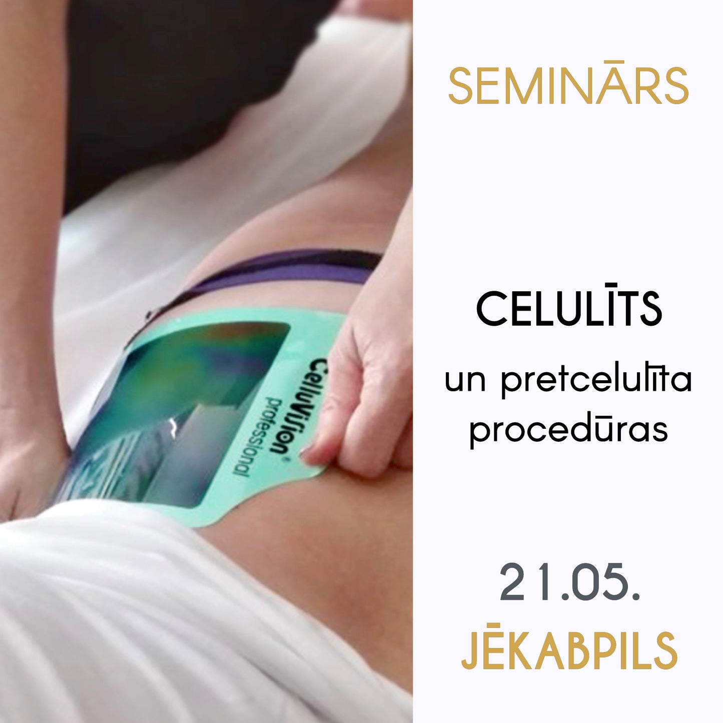 Seminārs 21.05. Jēkabpilī: «Celulīts un pretcelulīta procedūras»